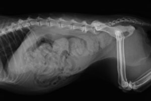 巨大結腸症のレントゲン画像